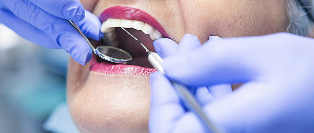 Best Broken or Chipped Tooth Repair in Henderson, GA